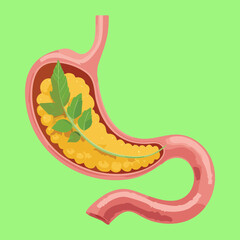 Simplified View of the Stomach Emptying Chyme into the Duodenum for Further Intestinal Digestion	