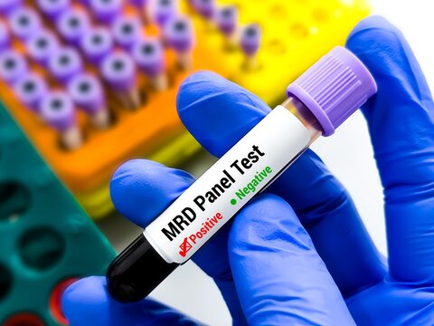 Measurable or minimal residual disease (MRD) Panel Test, a diagnostic tool used to detect and monitor cancer cells in patients who have undergone treatment.
