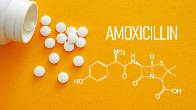 Amoxicillin white medical pills spilling out of a drug bottle. Chemical structure of amoxicillin sodium