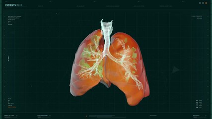 Medical Research 3D Software Loading. Analyzing the Patient`s Data using the 3D model Projection of Human Lungs. Slowly Scanning 3D model of Organ. Finding the virus traces. Computer User Interface. - Powered by Adobe