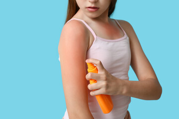 Little girl with red sunburned skin applying cream on blue background, closeup