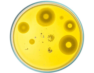 Petri dish with various microbial colonies