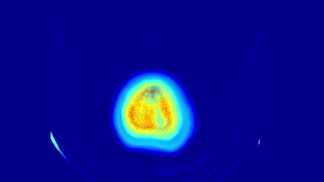 Detailed MRI Scan of the Human Brain Highlighting Anatomical Structures and Brain Tissue in Vibrant Colors for Advanced Neuroimaging Analysis and Study
