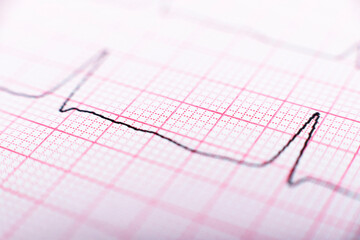Health care background of Electrocardiogram plot