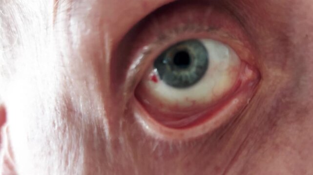 Human eye in extreme detail-aged iris textures, burst vessel, and natural skin folds evoke realism, emotion, and times imprint with striking clarity and depth
