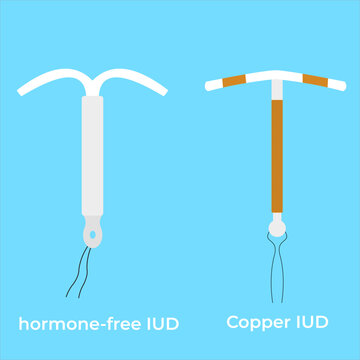 Combination of hormonal and copper IUDs, effective intrauterine birth control options, flat art design style.
