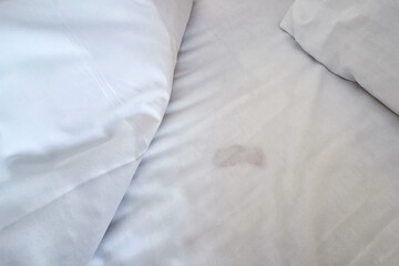 Dirty stained linen bedsheet in hotel room due to lack of quality control over cleanliness.