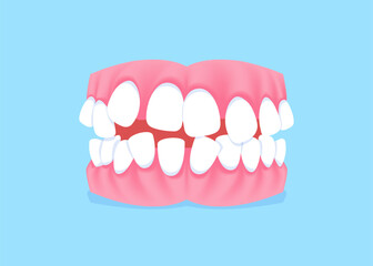 Full mouth teeth - Crooked illustration vector design. Dental care concept.
