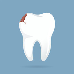 Tooth Decay Urgent Oral Health