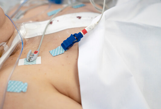 Patient receiving intensive care in hospital bed