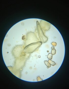 Microscopic view of struvite crystals from urinary sediment, identifying magnesium ammonium phosphate crystals linked to Feline Lower Urinary Tract Disease. Analysis of urine sample under