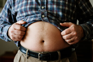 A middle-aged man lifts his plaid shirt to check his large belly, symbolizing concern about weight gain.