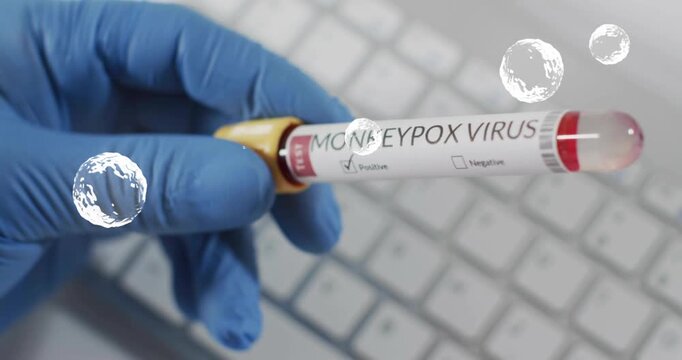 Lab tech holding monkeypox virus tube over keyboard initiating bubble graphics showing positive