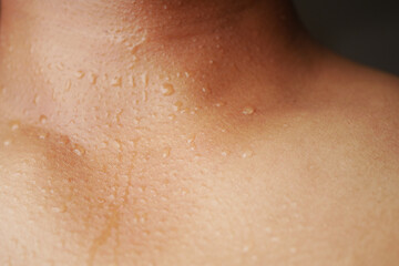 Close-up of skin showing beads of sweat during a hot and humid moment