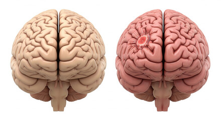Brain Cross-Section with Realistic Pathology