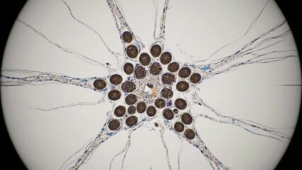 A detailed microscopic zoom of a stained plant root crosssection revealing the intricate starshaped actinostele vascular cylinder and cellular structures for scientific research and education.