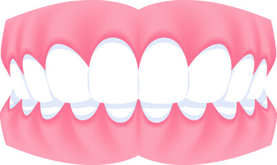 Full mouth teeth - Overbite illustration transparent design. Dental care concept.
