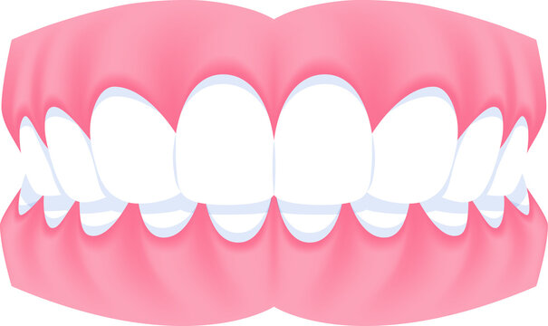 Full mouth teeth - Overbite illustration transparent design. Dental care concept.
