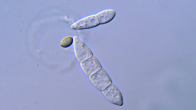Fusarium Macroconidia Observed Under Microscope, 1000x magnification 