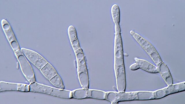 Fusarium Hyphae and Spores in High Definition,  1000x magnification 