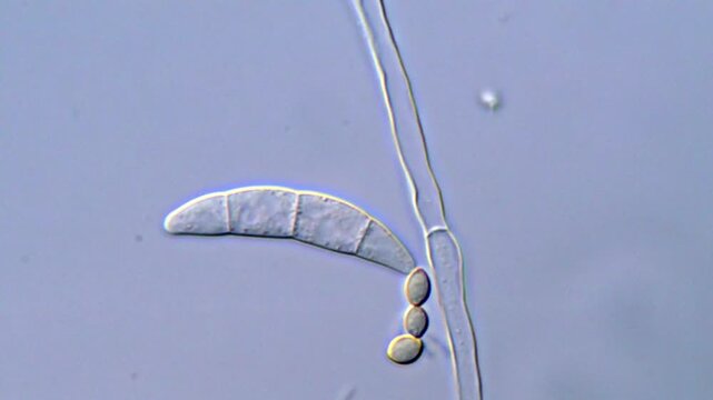 Fusarium Mycelium and Spore Formation in Detail