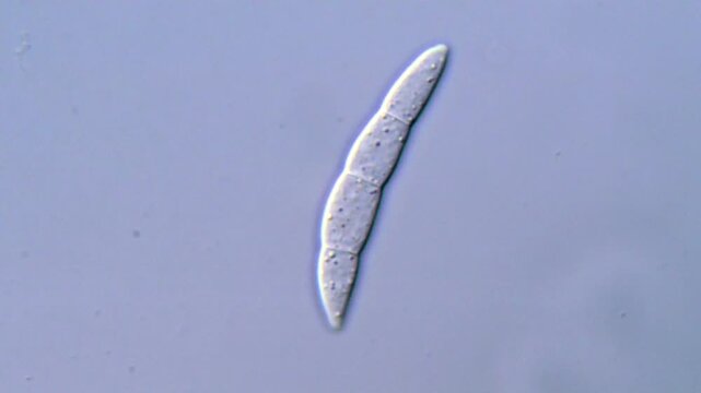 Microscopic Observation of Fusarium Pathogenic Spores