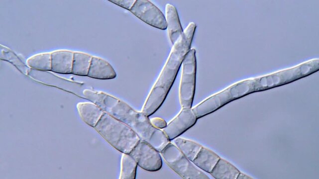 Fusarium Spores and Hyphae Under Compound Microscope