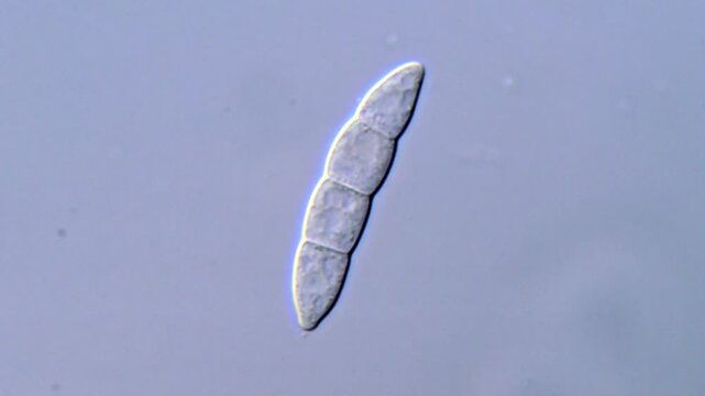 Fusarium Fungus Spore Microscopy in ultra HD Video