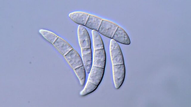 Fusarium Spore Microscopy for Scientific Observation