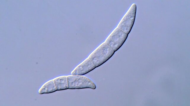 High Resolution Microscopy of Fusarium Spores, 1000x magnification 