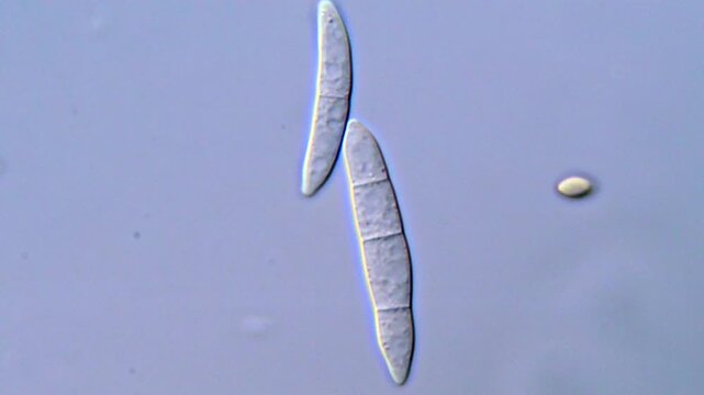 Fungus in mold rice under microscopy view 