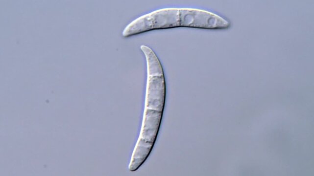 Fusarium Spore Morphology Under High Resolution