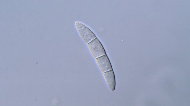 Fungi structures under microscope 