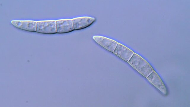 Fungi spores under microscope 