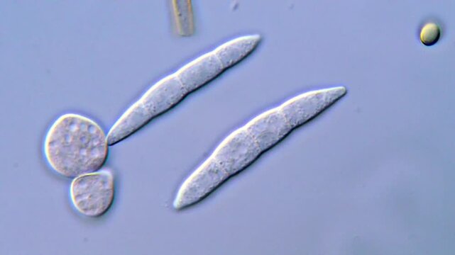 Fungal spore under DIC microscopy 
