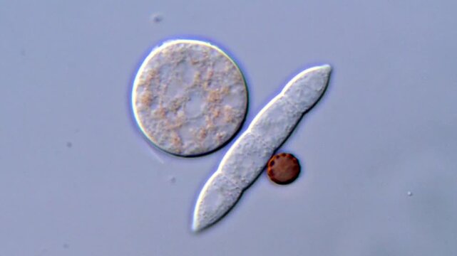 Fungi spores in high Resolution under microscopy 