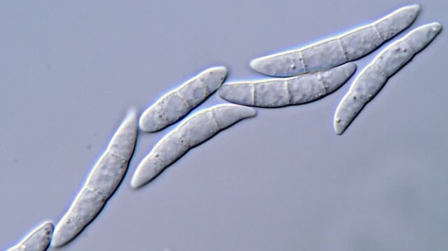 High Resolution video of fusarium fungi spore under microscopic view 