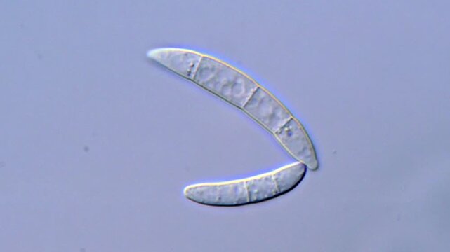 Plant pathogenic fungi spores under microscope high Resolution 