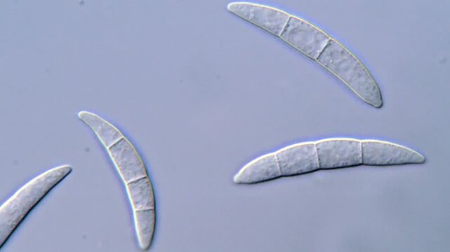 Pathogenic Fusarium Spores Viewed Under Microscope