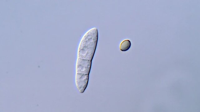 Phytopathogenic fungi spore under microscopy view 