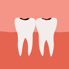 A vector illustration of two teeth affected by caries or tooth decay. The image shows cavities or dark spots on the surface of the teeth, representing unhealthy dental conditions