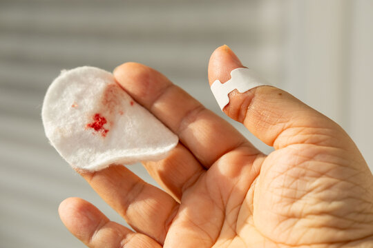 Tiny cut on fingertip, Close up injured thumb with bleeding skin, splinter wound on finger detail, painful hand injury, medical first aid, hygiene awareness, personal care, everyday accident