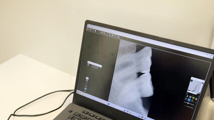 Dental X-ray reveals hidden molar mysteries, digital odyssey for Toothache Awareness Day, dental...
