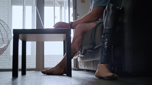 Disabled man with a modern bionic leg prosthesis working remotely on a laptop in his living room