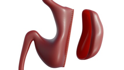 A 3D medical rendering that illustrates the procedure known as a Sleeve Gastrectomy or Gastric Sleeve. To reduce the size and capacity of the stomach to induce weight loss.