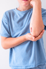 Scratch is visible on the elbow of 9 year old boy, indicating minor injury and typical occurrence...