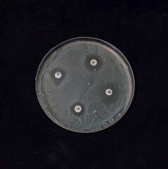 Bacterial culture in petri dish with antibiotic discs