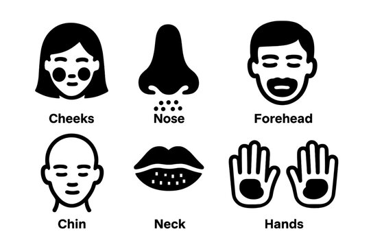 Windburn Icon Set. Solid, filled icon set of windburn affected areas: cheeks, nose, lips, forehead, chin, neck, ears, hands. Line icons in only black color.