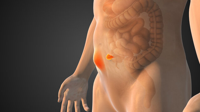Medical Animation Video of Stomach Hernia Development