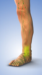 Pitting Edema Resulting from Fluid Accumulation